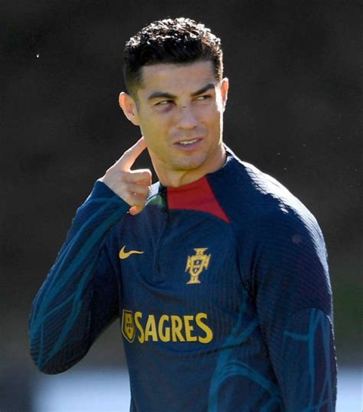 Cristiano Ronaldo Trains With Black Eye After Portugal Incident (Photos)